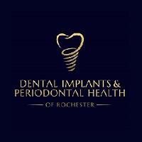 DentalImplants PeriodontalHealth